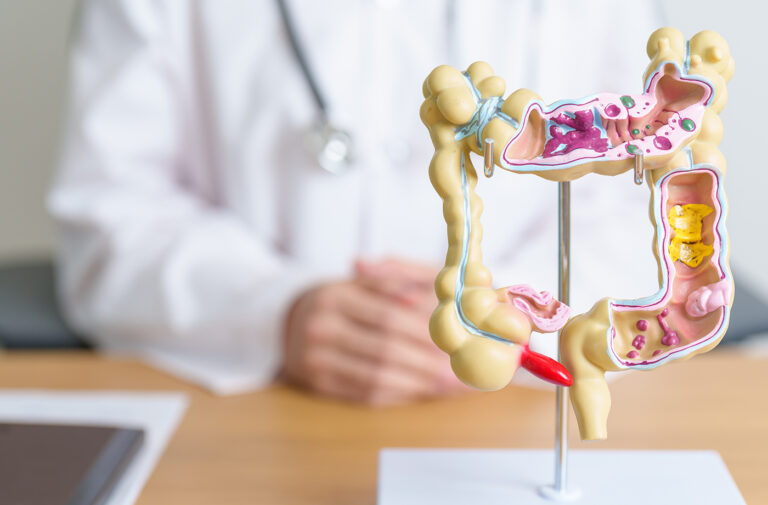Prevalence of gastrointestinal symptoms in the UK adult population and perceived effects of foods